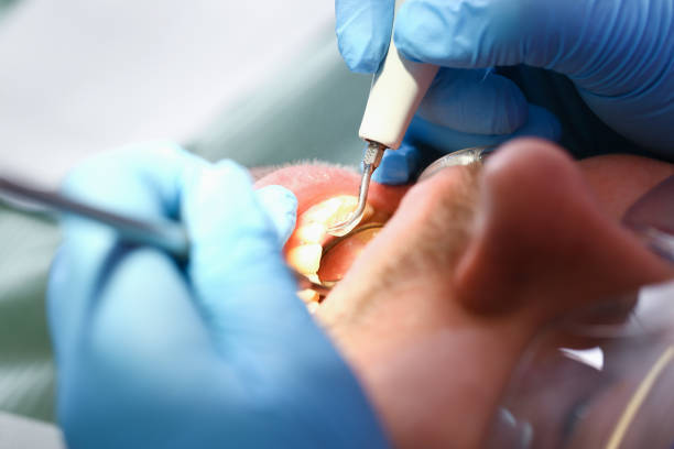 Best Emergency Tooth Extraction  in Escobares, TX