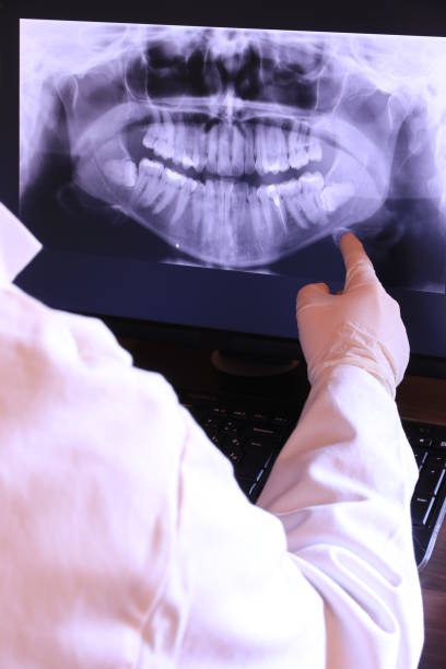 Best Tooth Infection Emergency Dentist  in Escobares, TX