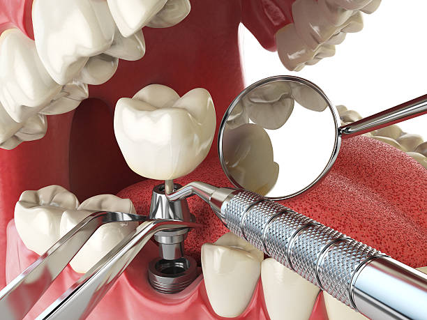 Best Urgent Tooth Repair  in Escobares, TX